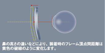 レンズと瞳との距離は「角膜頂点間距離」と呼ばれる。 「角膜頂点間距離」は、フレームの形状や調整、鼻の高さにより変化する。