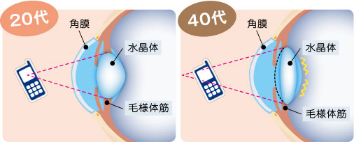 近くのものにピントを合わせるのには、水晶体を膨らませる。しかし、年齢を重ねるにつれて水晶体の弾力が低下。40代になるとピント調整力が衰え、近くのものが見づらくなり、「瞳の曲がり角」を迎える。 image by SEED