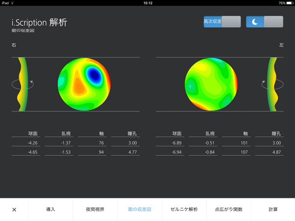 i.Scription®が解析した「眼の収差図」。ほぼ全域がグリーンで彩られた左眼に対して、右眼はオレンジや青の収差が多い部分も目立つ。